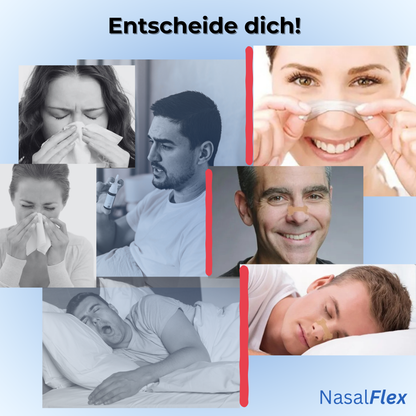 NasalFlex